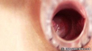 Ema speculum nurse uniform masturbation dampilp at clinic